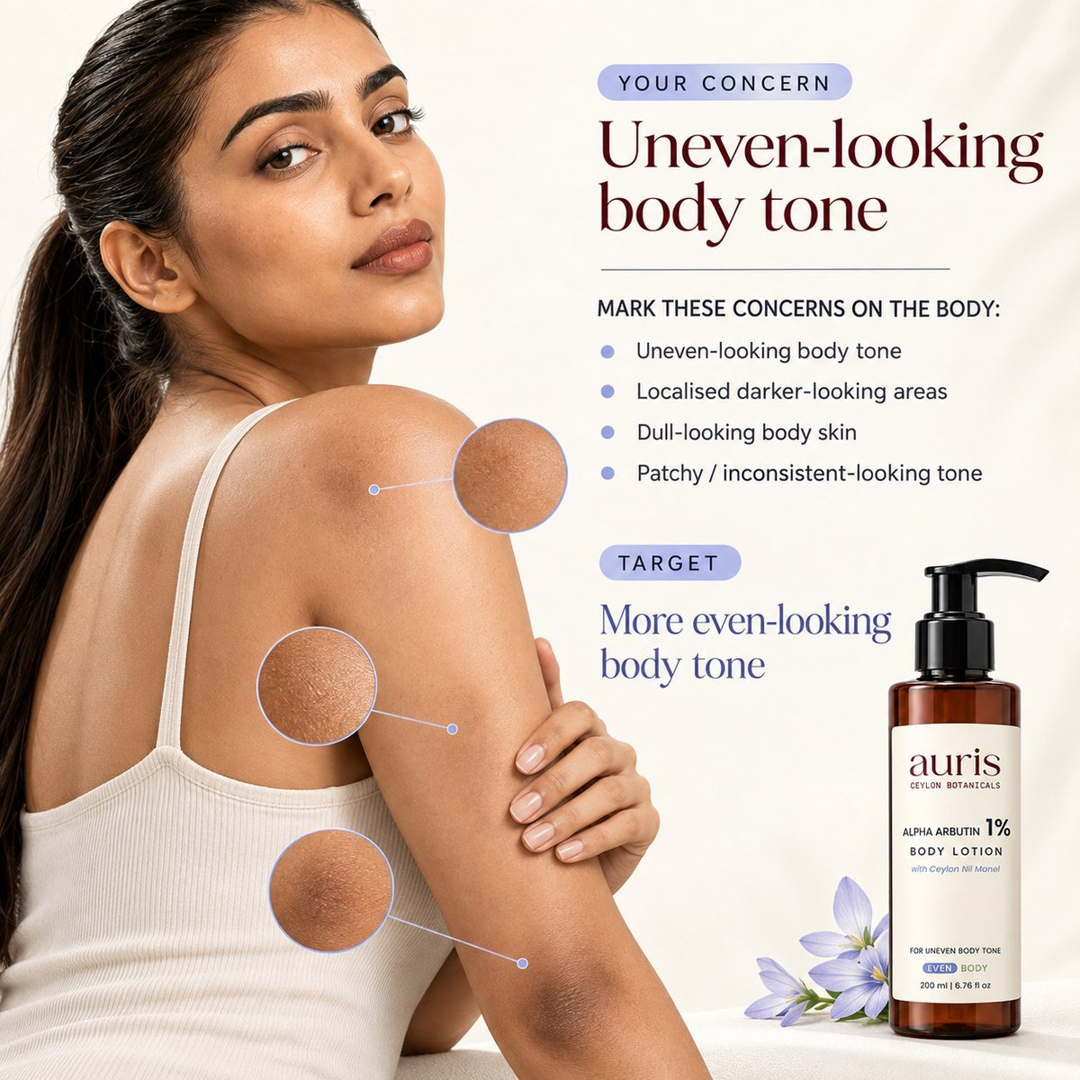 Model with uneven-looking tone on the arms and shoulders, alongside Auris EVEN Alpha Arbutin 1% Body Lotion with Ceylon Nil Manel