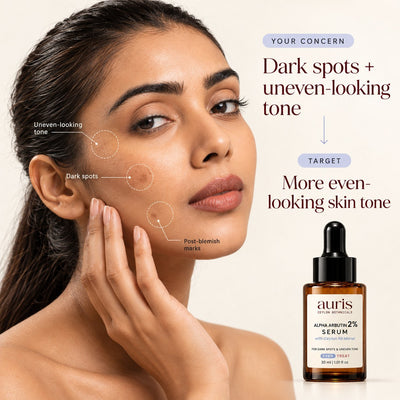 OLD (restored for review) — Model with dark spots, post-blemish marks and uneven-looking tone, alongside Auris EVEN Alpha Arbutin 2% Serum with Ceylon Nil Manel